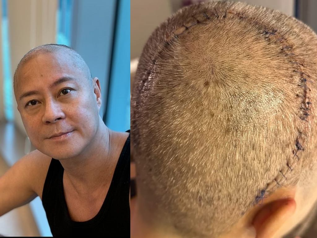 GRASSHOPPER announces concert return | theHive.Asia GRASSHOPPER announces concert return, Calvin Choi, celeb asia, grasshopper, Remus Choy, theHive.Asia, collage