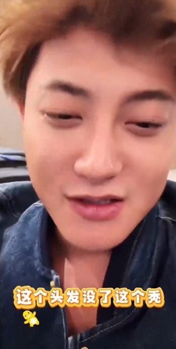 Huang Zitao reveals past struggle with alopecia areata | theHive.Asia Huang Zitao reveals past struggle with alopecia areata, celeb asia, huang zitao, theHive.Asia