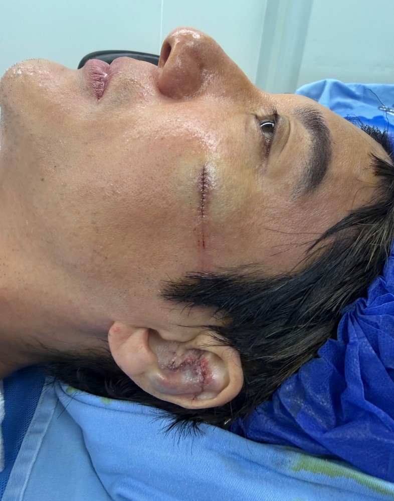 Wang Leehom needed 27 stitches after tripping on safety cable onstage | theHive.Asia Wang Leehom needed 27 stitches after tripping on safety cable onstage, celeb asia, wang leehom, theHive.Asia