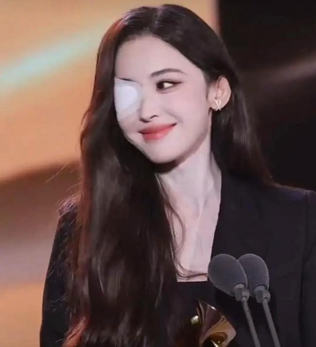Guli Nazha says eye condition has yet to fully recover, Gulinazha, theHive.Asia, Guli eye patch